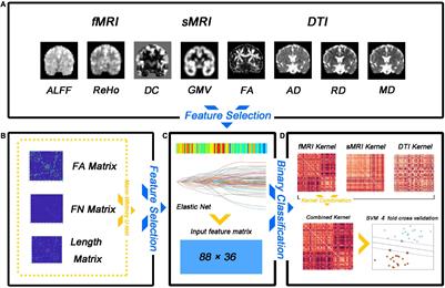 Multivariate Pattern Analysis of Lifelong Premature Ejaculation Based on Multiple Kernel Support Vector Machine